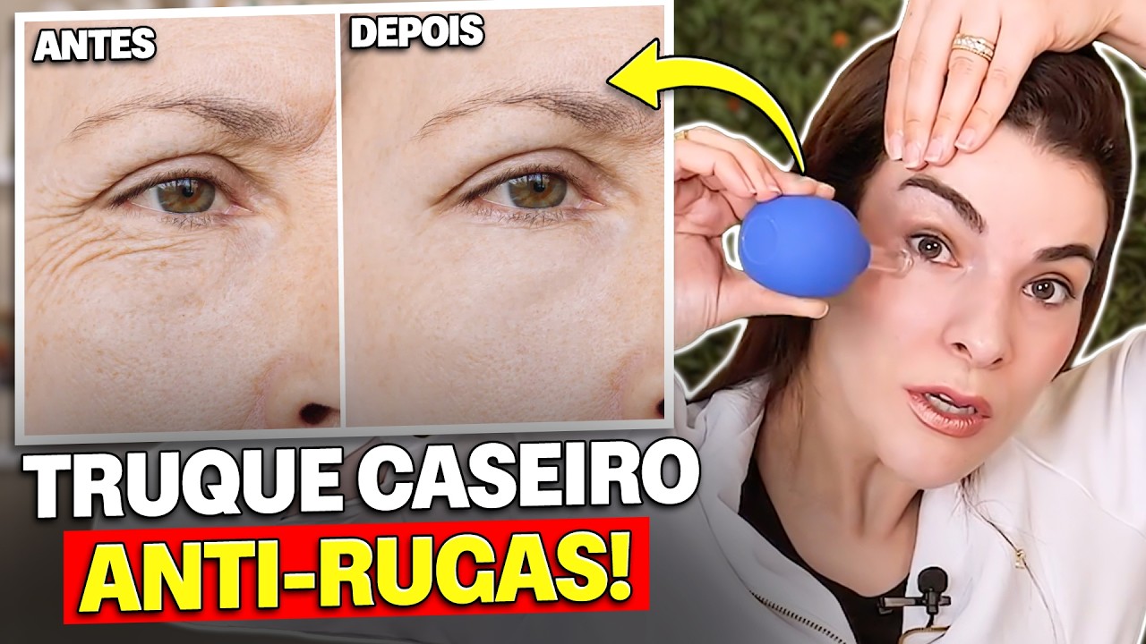 ACABE com As RUGAS!! VACUOTERAPIA CASEIRA