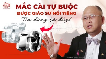 Niềng Răng Mắc Cài Tự Buộc Được Giáo Sư Chris Chang Hay Dùng Là Đây! | Nha khoa Sdental