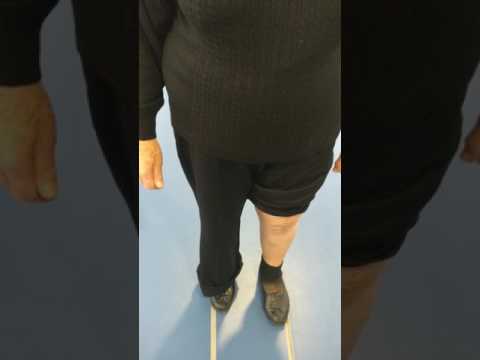 Ολική Αρθροπλαστική Γόνατος