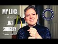 My LINX Story - LINX Surgery Testemonial [Honest Review]