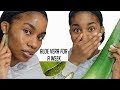 I used Fresh Aloe Vera on My Face for A WEEK...This is what happened.