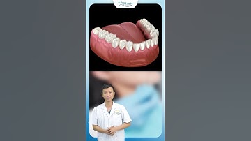 Niềng Răng InviSalign | Bác Sĩ Yên