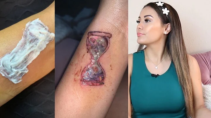 Me tatuaron mal y la remocion salio peor! (con fot...