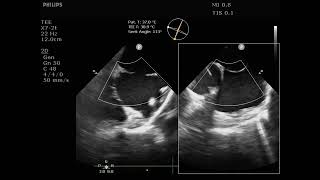 Asd గడ ల రధర