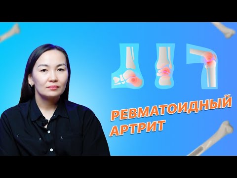 Как предупредить ревматоидный артрит?