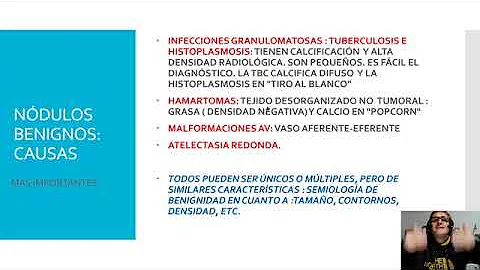 ¿Puede crecer un nódulo pulmonar benigno?