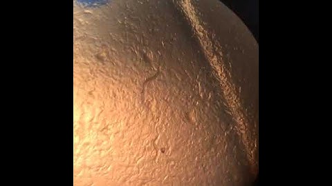 C. elegans unc-22 mutation