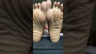 Ebony- mature  super wrinkled soles