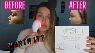 lightstim anti aging kezelés