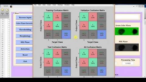 Blood Group Detection using Neural Network Matlab Project Code