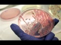 Juliet Antibiotic Resistance com225