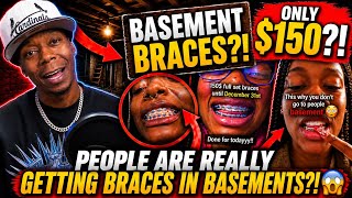 The ‘Basement Braces’ Trend Is INSANE (Dentists Are Furious)