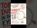 Your Eye Doctor Says You Have TOBACCO DUST In Your Eye? #Floaters #RetinalTear #EyeHealth