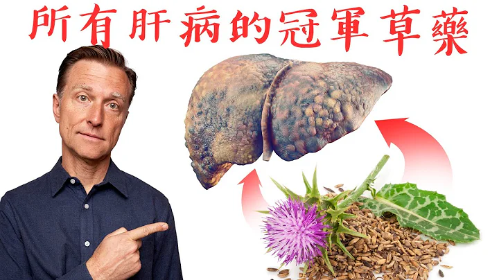 肝病的冠军草药奶蓟,脂肪肝,肝炎和肝硬化,自然疗法,柏格医生 Dr Berg - 天天要闻