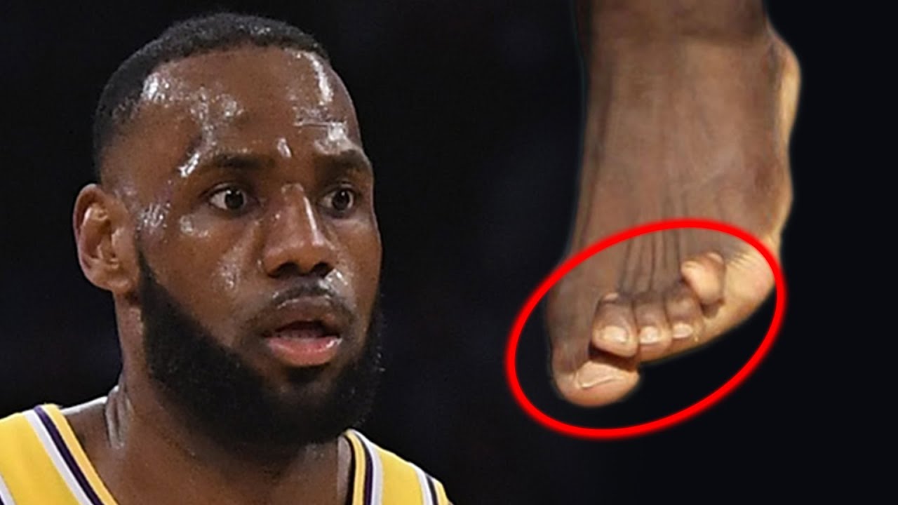 lebron james foot