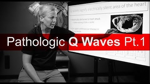 Q Wave Pathology Pt.1