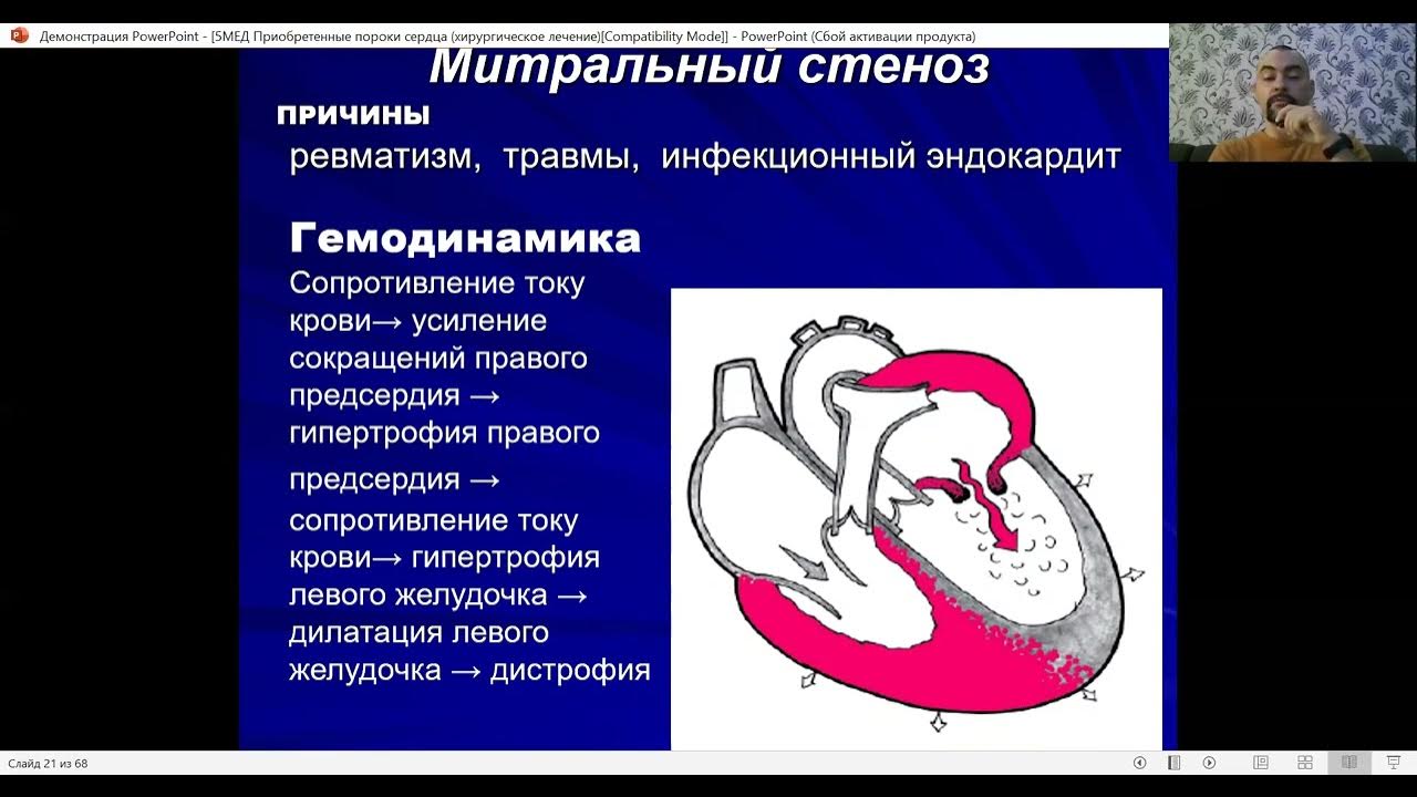 Митральная недостаточность гемодинамика