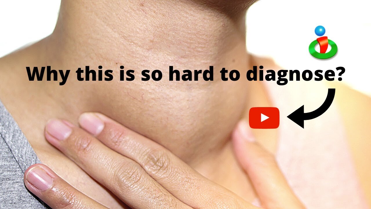 Why thyroid issues are hard to diagnose YouTube