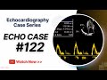 ECHO CASE 122: Echocardiography For Beginners - Spot Diagnosis