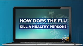 CBS2's Dr. Max Answers Your Questions On The Flu