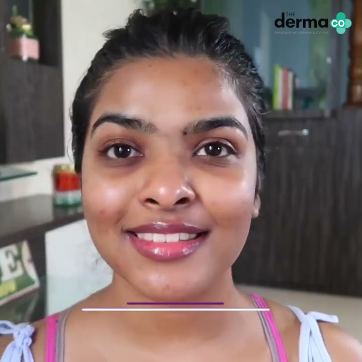 The Derma Co | Benefits of 30% AHA   2% BHA Peeling Solution
