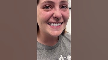 Ashley | Affordable Dentures & Implants Moments