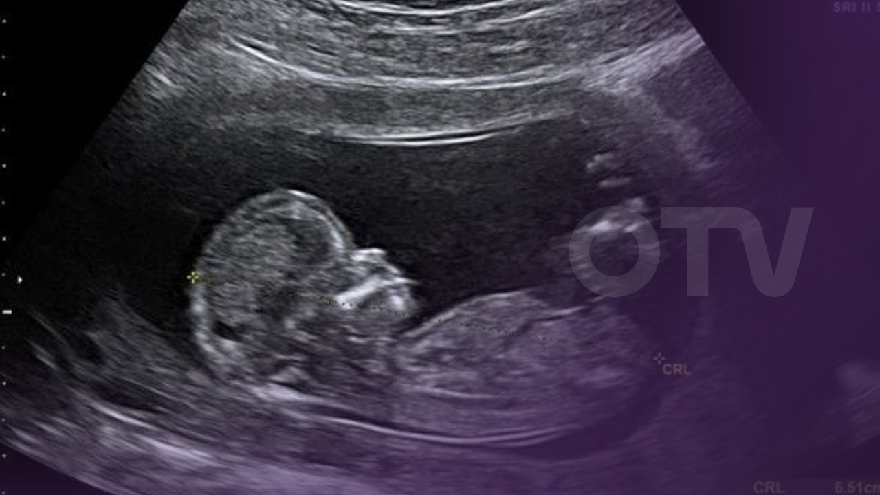 ماذا تعرفون عن 