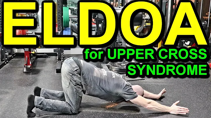 HOW TO CORRECT UPPER CROSS SYNDROME: Top 5 ELDOA Exercises for Posture Correction