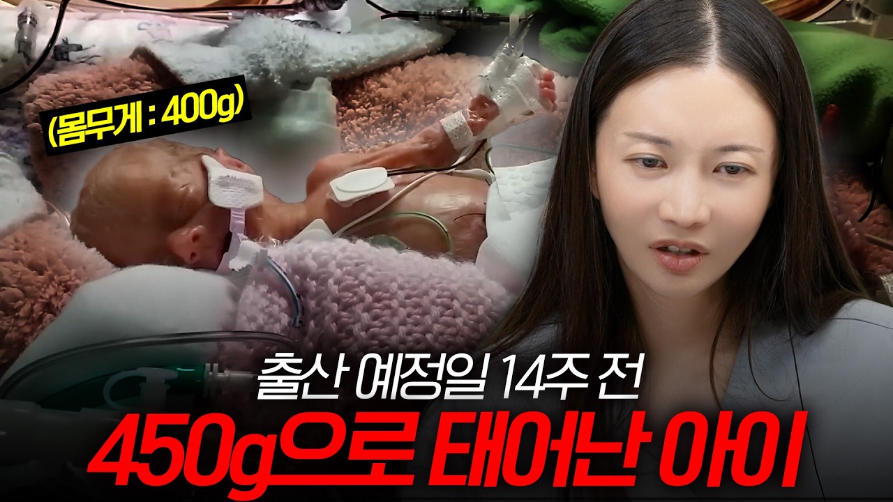 이 아기는 예정일보다 '14주' 일찍 태어났습니다