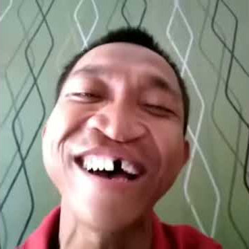 Viral !! Penyanyi Gagu Gegerkan Dunia Maya
