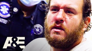 3 Nose Injuries That Turned Into 911 Calls  Nightwatch  Ae