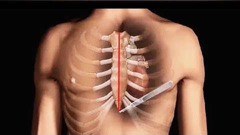 Blood block operation | educational video | best Satisfying Video