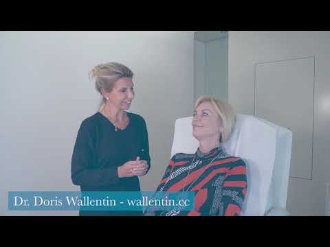 Radiesse: Fillerbehandlung bei Dr. Doris Wallentin