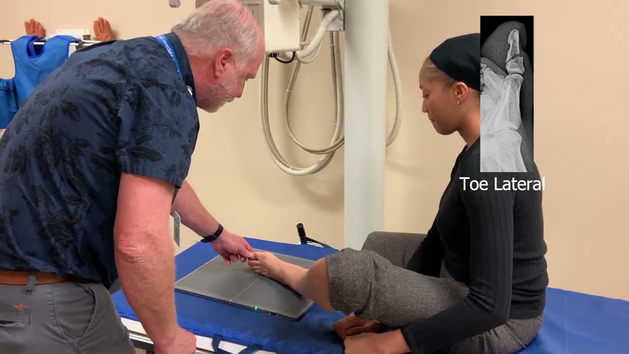 Toes - X Ray Positioning