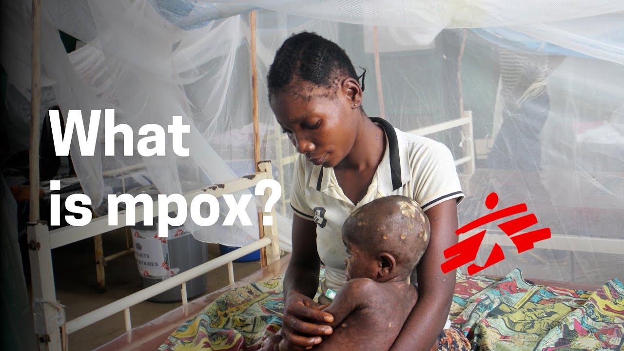 Mpox: what is it and why is there growing concern about the outbreak in DR Congo?