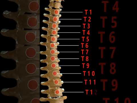 Vidéo: Est-ce que la fusion des vertèbres fonctionne ?