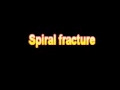 What Is The Definition Of Spiral fracture Medical School Terminology Dictionary
