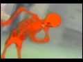 Red skeleton nigga