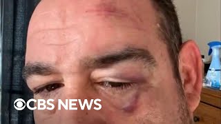 Officers stabbed, injured in Massachussetts prison