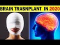 क्या 2020 में BRAIN TRANSPLANT करना सम्भब है | Future Of Brain Transplant I