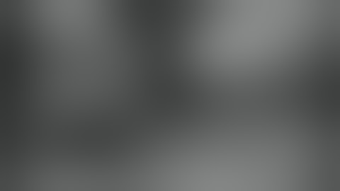 Craniectomy (1929) Pt. 2 of 2