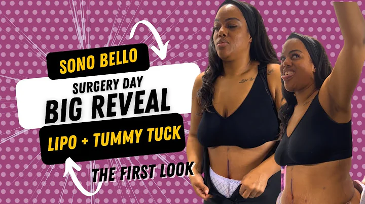 SONOBELLO SURGERY DAY- THE BIG REVEAL/FIRST LOOK