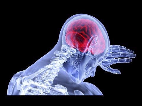 Moi Starts Incision Free Brain Surgeries Youtube