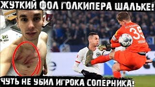 Чудовищный Фол Вратаря Шальке! Александр Нюбель Жёстко Прерывает Атаку Айнтрахта!