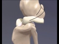 Cranial cruciate ligament rupture  3d animation for veterinary undergraduates
