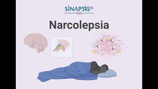Narcolepsia, todo lo que necesitas saber.