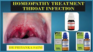 THROAT INFECTION || HOMEOPATHY TRETAMENT || infection and cough  chest pain @dr.priyankashomeopathy