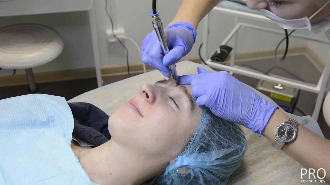Алмазный пилинг на аппарате Pristine - как проходит процедура