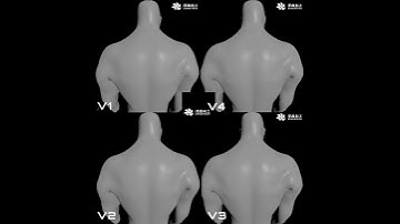 GPU-Based FEM Fascia-Skin Simulation