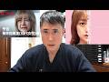 【ダウンタイム症例解説⑥】板井佐緒里(30代キャバ嬢)・口角挙上術【安達祐実】